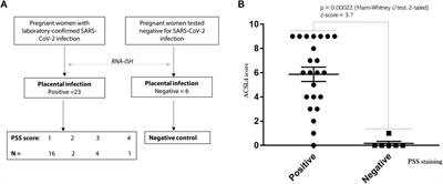 SARS-CoV-2 infection induces activation of ferroptosis in human placenta